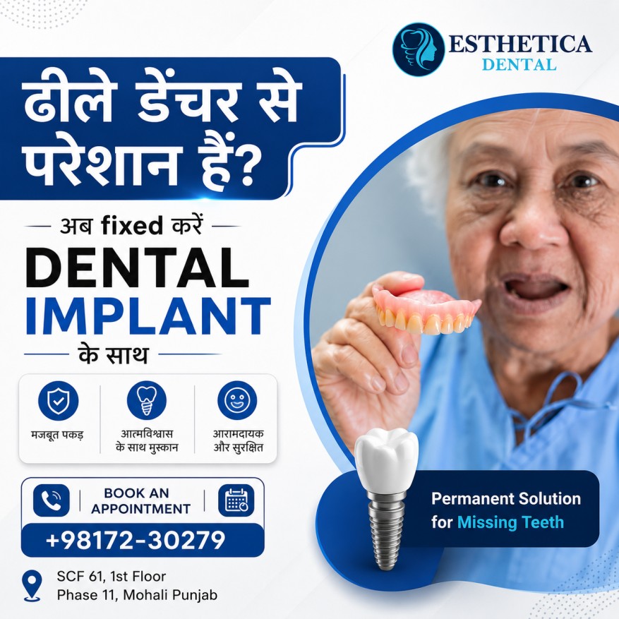 Dental Implants in Mohali